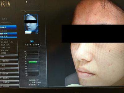 皮膚檢測儀哪家強？Visia、美圖宜膚、A-one實測深度對比