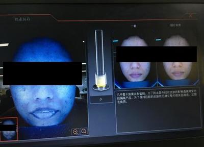 皮膚檢測儀深度實測 Visia、美圖宜膚、A-one究竟哪家強？